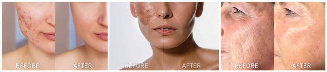 Kim’s Skincare Protocol Real Customer Experience